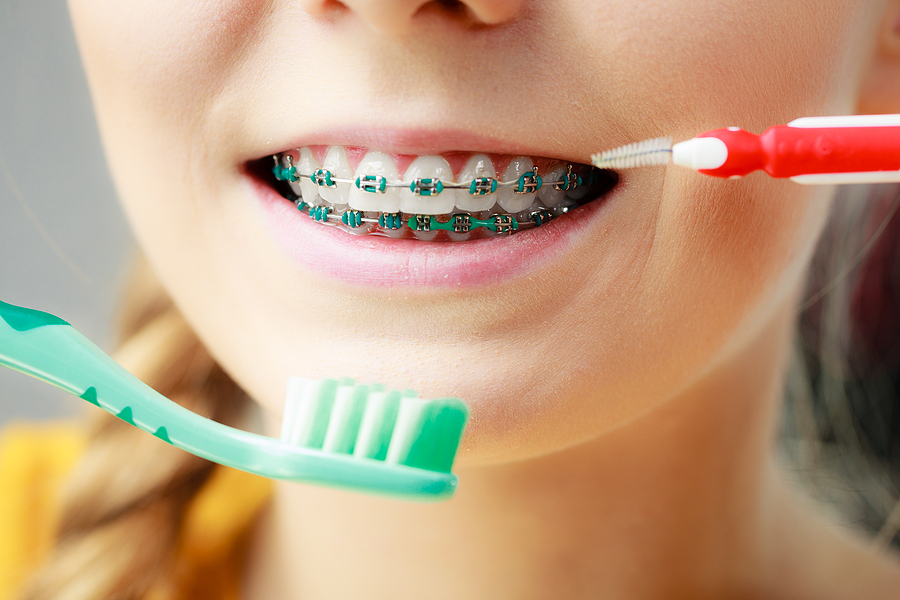 Carroll Orthodontics Carroll Orthodontics